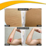 Professional Instant Body Concealer