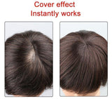 Hair Toppers - 100% Human Hair