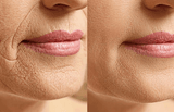 Rejuvenating Lifting Face Massager