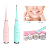 Sonic Plaque Remover